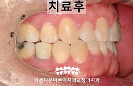 수술후