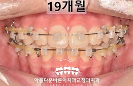 수술후