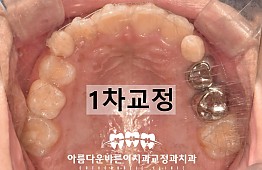 수술후