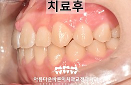 수술후