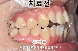 수술전