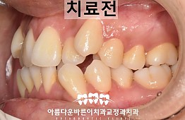 수술전