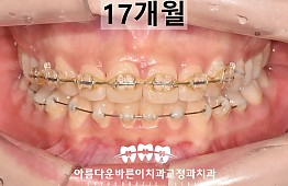 수술후