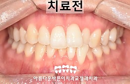 수술전