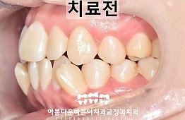 수술전