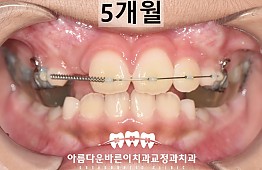 수술후