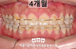 수술후