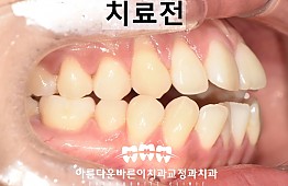 수술전