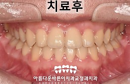 수술후