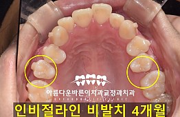 수술후