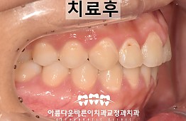 수술후