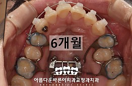 수술후