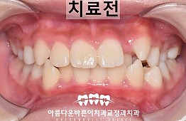 수술전