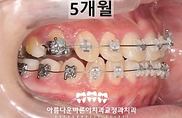 수술후