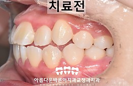 수술전