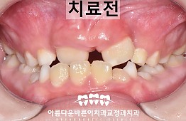 수술전