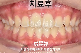 수술후