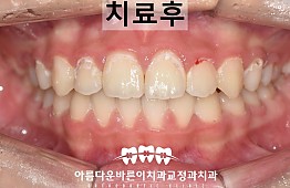 수술후