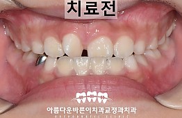 수술전