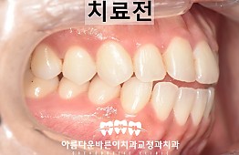 수술전