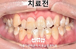 수술전