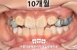 수술후