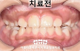 수술전