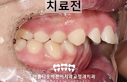 수술전