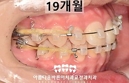 수술후