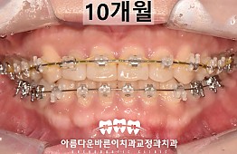 수술후