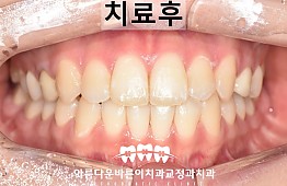 수술후