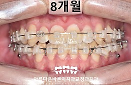 수술후