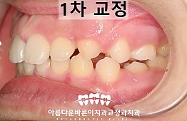 수술후