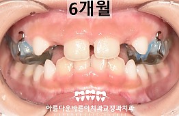 수술후