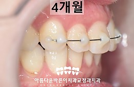 수술후