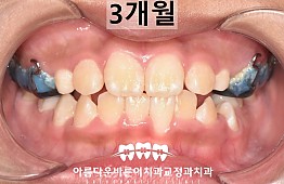 수술후