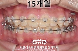 수술후