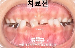 수술전