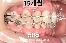 수술후