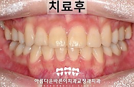 수술후