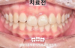 수술전