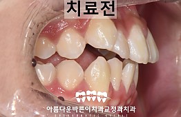 수술전