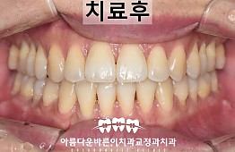 수술후