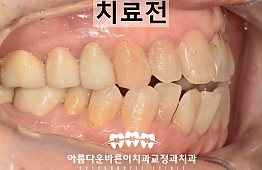 수술전