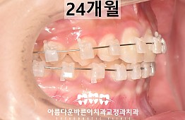 수술후