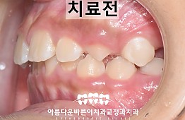 수술전