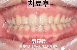 수술후