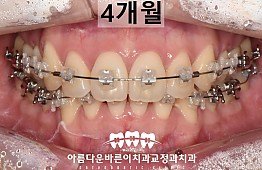 수술후