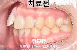 수술전