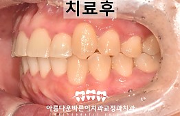 수술후